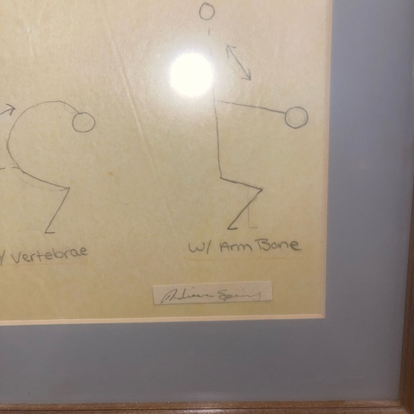 Framed Anatomy Art Spine Replaced With Arm Bone 21” x 13” Interesting Piece - Picture 3 of 9